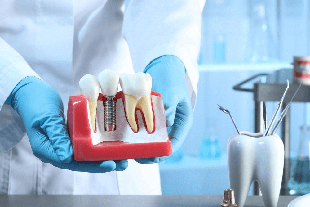 Difference between Normal Teeth and Dental Implants