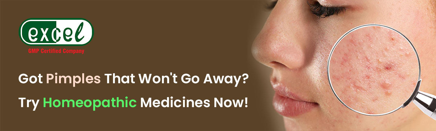 Got Pimples That Won’t Go Away? Try Homeopathic Medicines Now!
