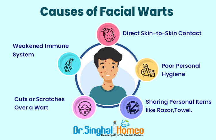 Homeopathy Treatment for Warts