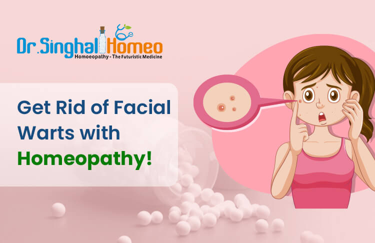 Can I Get Rid of Facial Warts with Homeopathy?