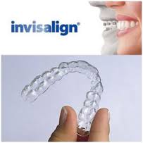 Why is Invisalign Preferred More than The Other Dental Treatments?