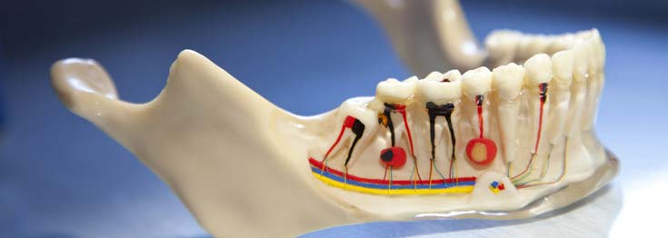 Root Canal Therapy in Melbourne Modern Dentistry