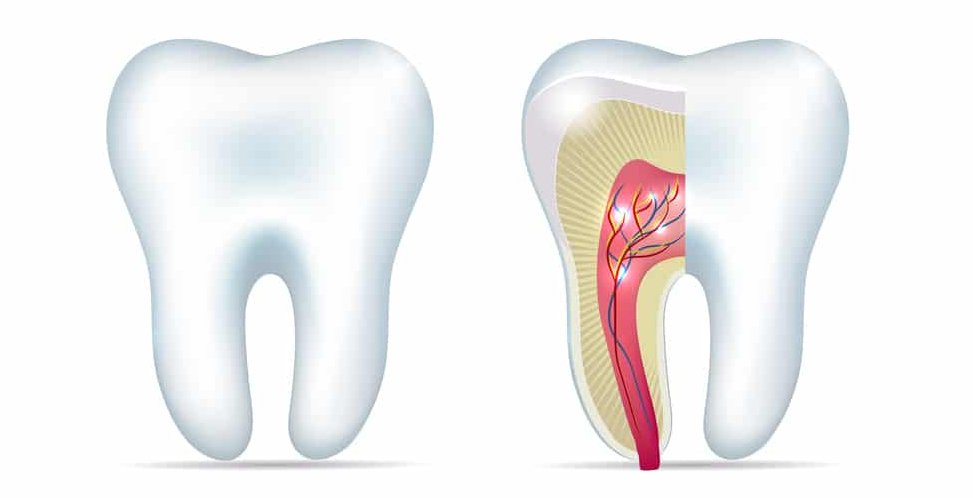 Why root canal therapy?