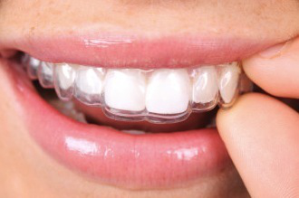 What to Look For In An Lancaster Implant Dentist?