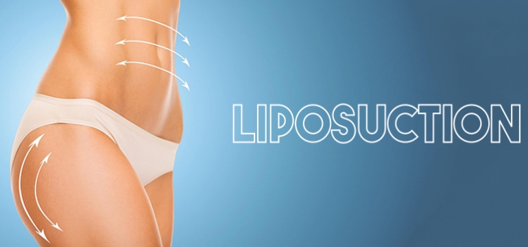 10 Risks and Benefits of Liposuction Surgery