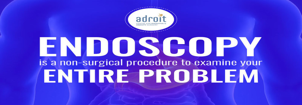Endoscopy Guide