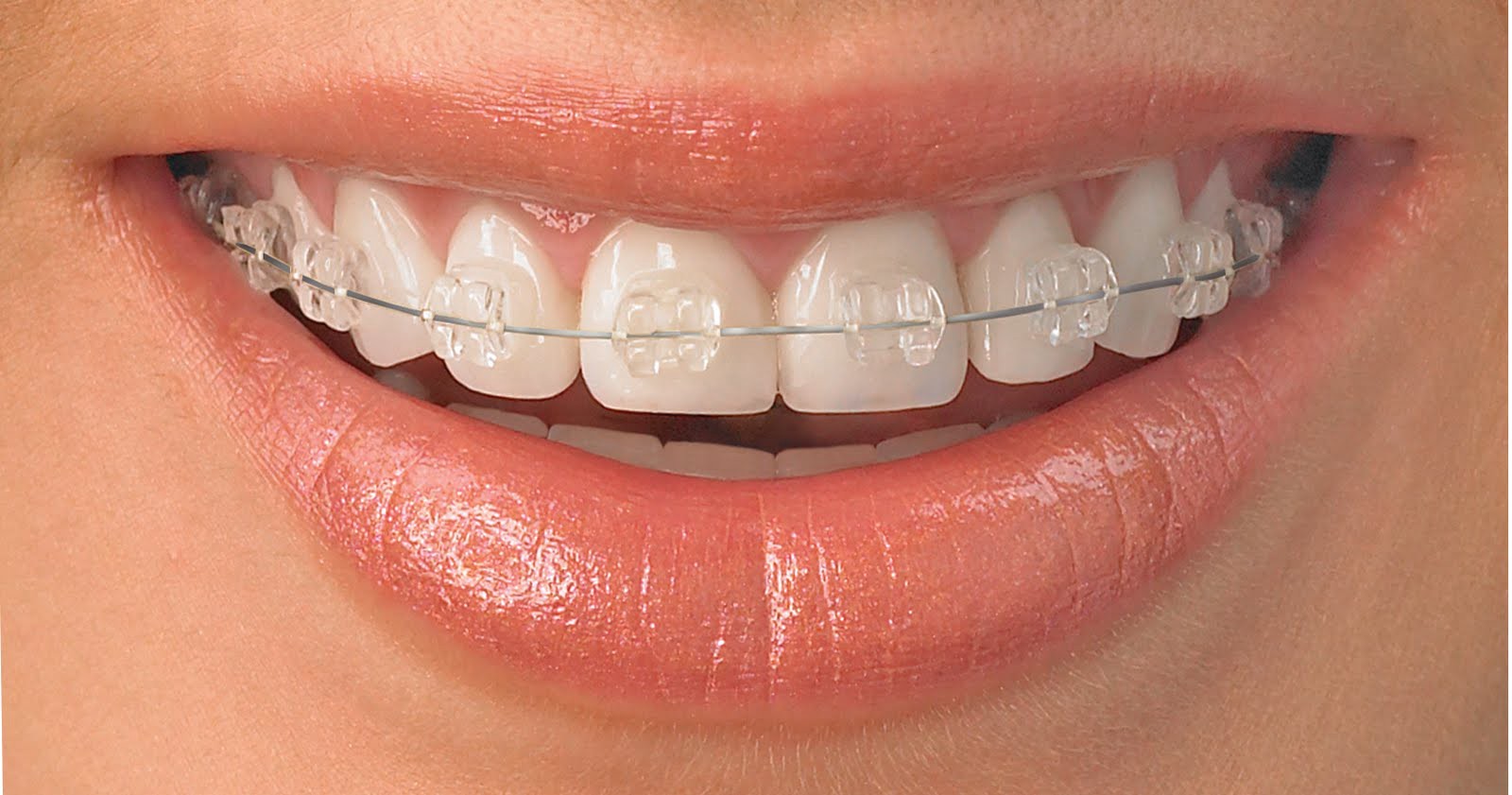 What are the services that you can get from Orthodontics Melbourne?