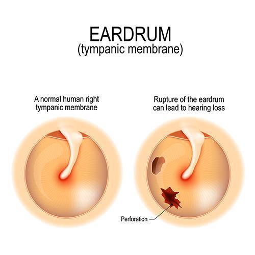 Eardrum