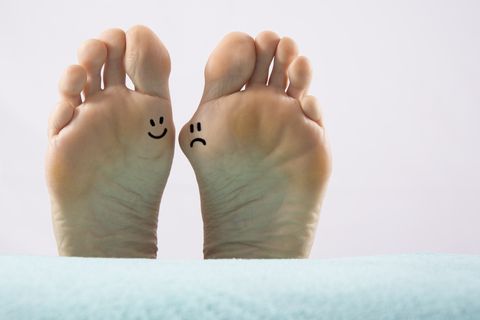 How to Treat a Bunion Without Surgery?