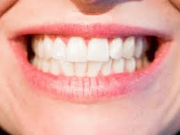 Where to Get Dentures and Zoom Whitening in Auckland CBD to do?