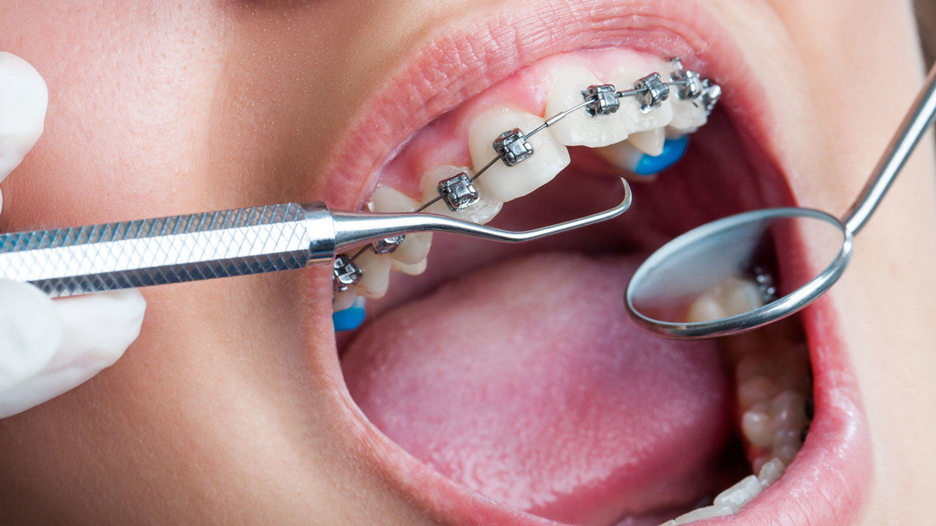 Can Orthodontist Education Help Treat Oral Problems in Children?