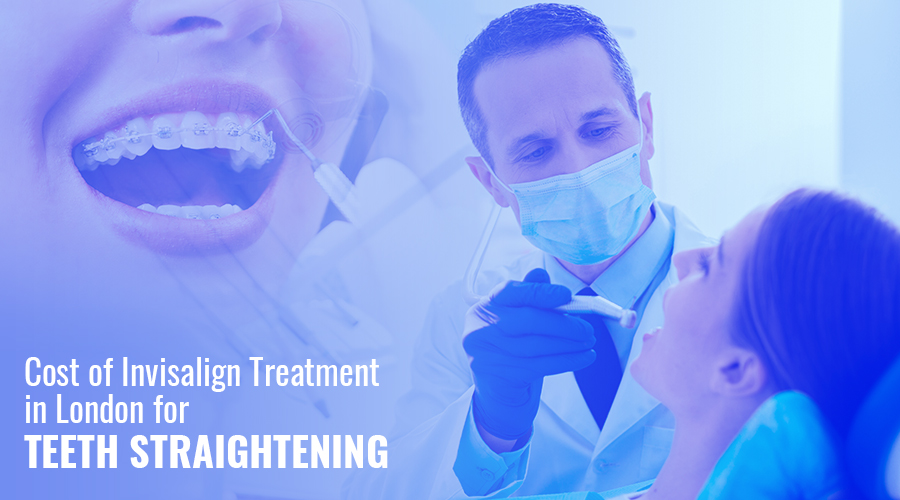 Cost of Invisalign Treatment in London for Teeth Straightening