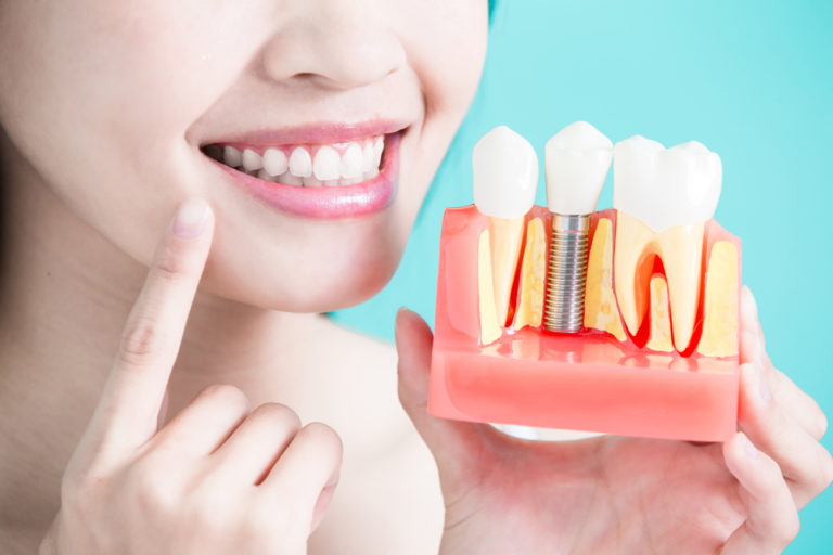 Dental pain? No more pain with Wisdom Teeth Surgery