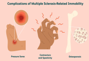 multiple sclerosis treatment in dubai