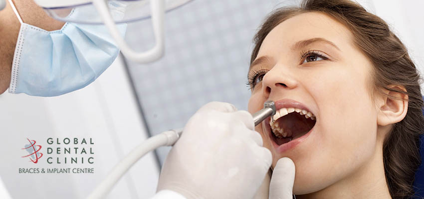 Root Canal Treatment – Much Better Experience Now
