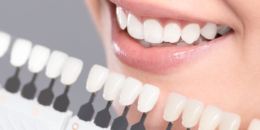 Questions to Ask Your Cosmetic Dentist in Tarzana Before a Treatment