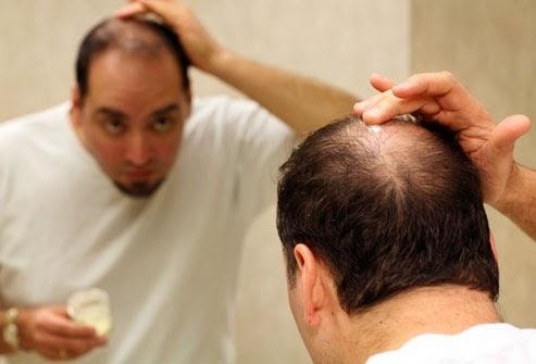 Hair Transplant Surgery in India