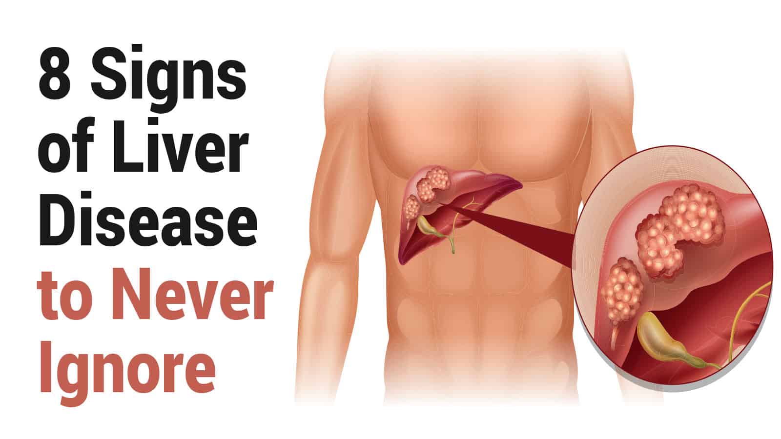 Liver Diseases And Its Symptoms